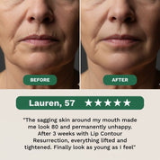 Lip Contour Resurrection cream - Erases Lines & Sagging