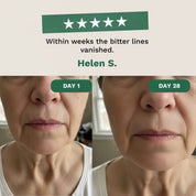 Lip Contour Resurrection cream - Erases Lines & Sagging