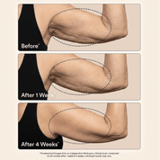 Crepey Skin Repair Cream