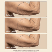 Crepey Skin Repair Cream