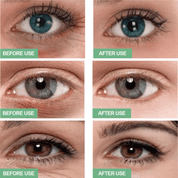 Aloe Vera Eye Masks – Dark Circle & Puffiness Solution (60 Pcs)